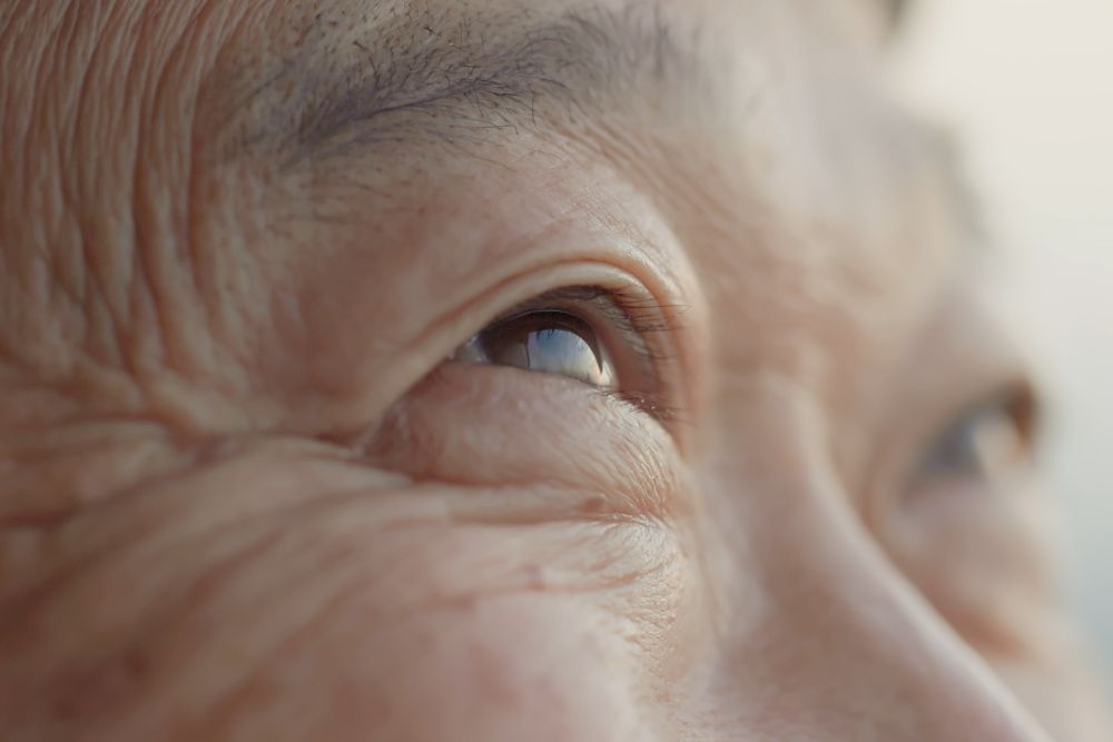 rcm-dry-amd-geographic-atrophy