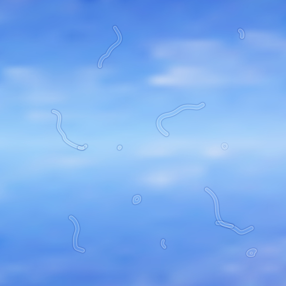 Flashes & Floaters